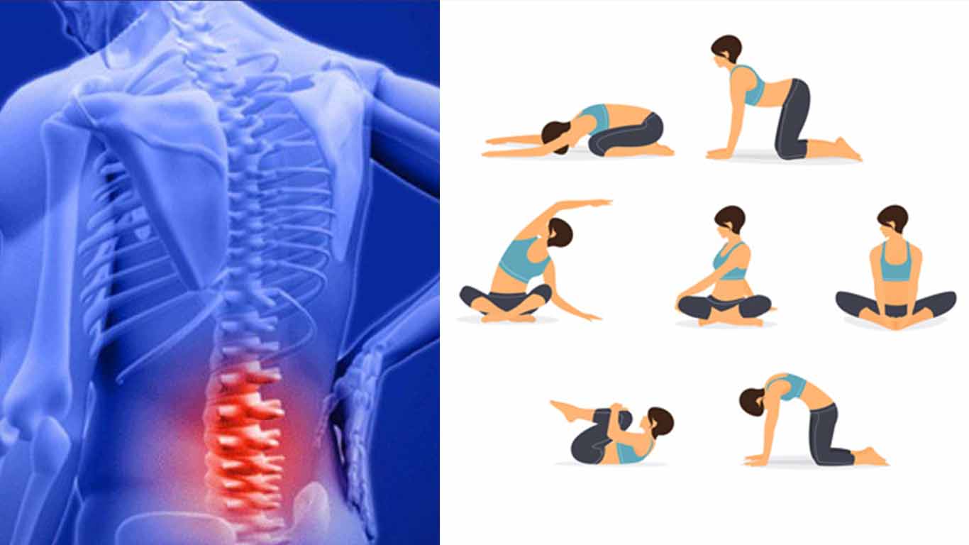 cure lower back pain with physiotherapy exercise